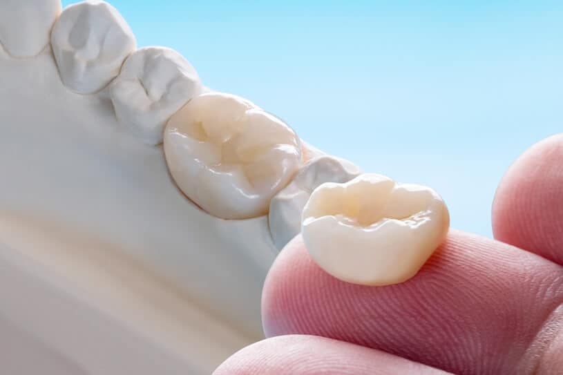 השתלות שיניים ושיקום הפה
